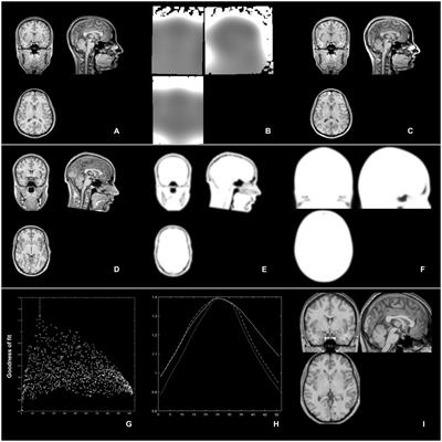A three-step, “brute-force” approach toward optimized affine spatial normalization